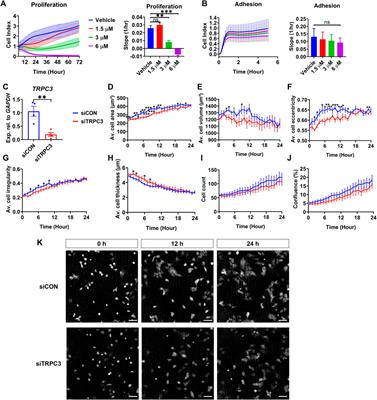 A role for TRPC3 in mammalian testis development